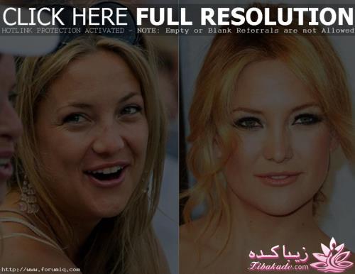 جراحی بینی - جراحی زیبایی